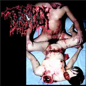 Torsofuck / Lymphatic Phlegm - Disgusting Gore And Pathology / Polymorphisms To Severe Sepsis In Trauma FLAC