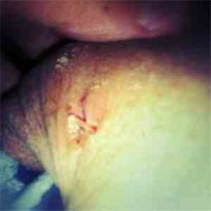 To The Lovers, Farewell - Vasectomy Vasect 2 You FLAC