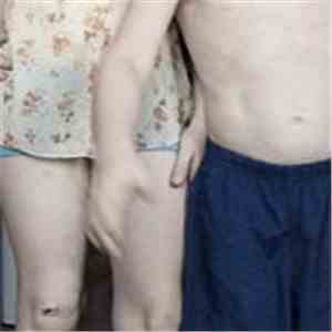 Albinos Agony - Albinos Agony FLAC